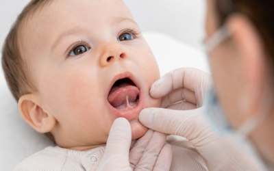 Anquiloglosia: qué es, síntomas y cuándo tratarla